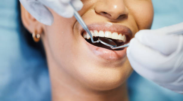 Best Emergency Wisdom Tooth Extraction in Lyons, KS