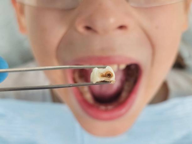 Best Emergency Denture Repair in Lyons, KS